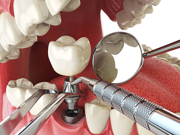 Best Emergency Gum Treatment in Cedar Grove, FL